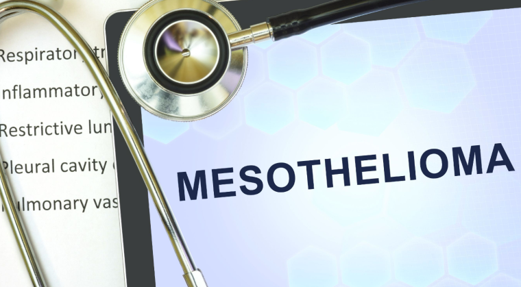 the-meaning-of-peritoneal-mesothelioma